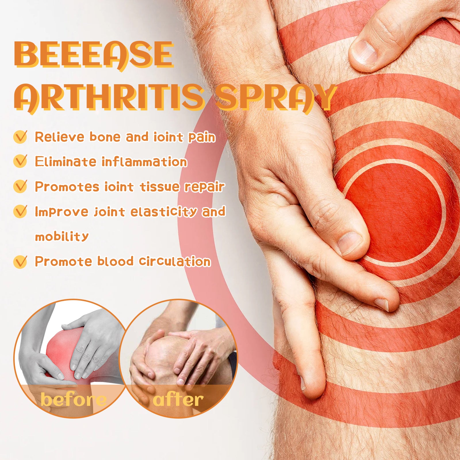 South Moon Beease Arthritis Spray, Relieve Joint Pain Shoulder Cervical Vertebra Lumbar Body Care Spray